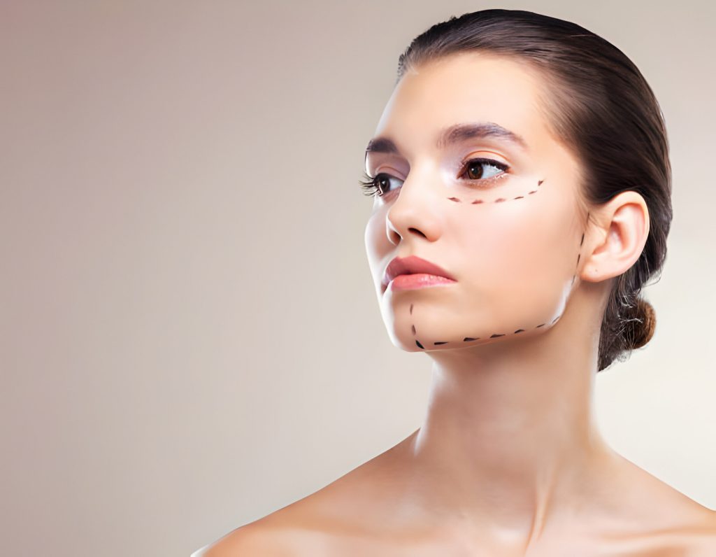 how long does botox take to work