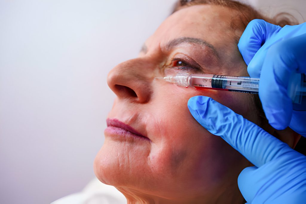 nose botox for deviated septum